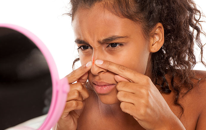 Acne vulgaris