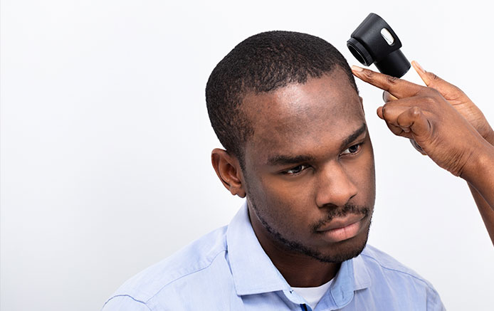 Pigmentary Skin Disorders and Hair Loss